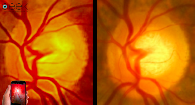 1417184072_peek-retina-comparison-image-640x346.png